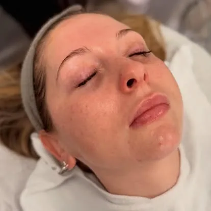 Professional facial treatment in progress