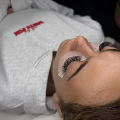 Dermaplaning