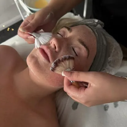 Chemical Peels training course
