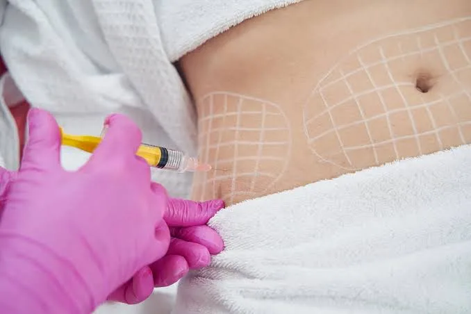 Fat Dissolving Training training course